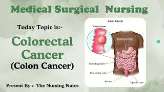 🎗️ Colorectal Cancer (Colon Cancer) | Causes, Symptoms, Diagnosis & Nursing Management