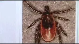 Wet spring welcomes an uptick in ticks, Lyme disease