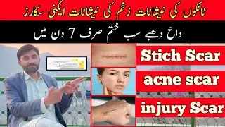 contractubex gel | acne scar removal | stitch scar removal | burn scar removal | surgery scar remove