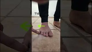 Corrigiendo mis dedos torcidos