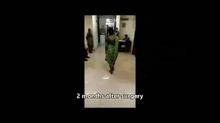 Total Knee Replacement Recovery | How Fast Can You Walk After Surgery? ! Dr. SK Gupta ! Orthopaedic