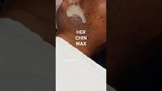 Watch This Wax Handle That! #Hirsutism #ChinWax #BeardWax