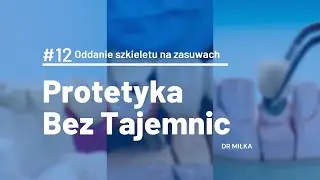 Protetyka bez tajemnic [PRAKTYKA #12] - Oddanie szkieletu na zasuwach