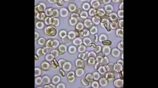 Human blood RBC under microscope