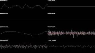 The King of Fighters '94 (Arcade) - Esaka (Japan Stage) - In Oscilloscope View!