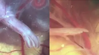 From dinosaur to chicken, hind limb development of chicken embryos