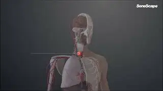 Micro F - a new technique to visualise minute haemodynamics