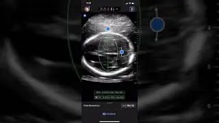 OB Calcs 1 | Clinical Image