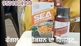 FUNGAL INFECTION RESULT WITH TRM FOOD SUPPLEMENTS