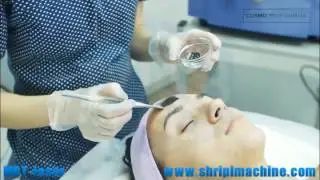 Q-switch ND YAG Laser tattoo removal system MBT 810