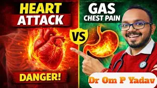 Gas pain or heart attack? How to identify it? #health #food #heartattack