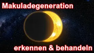 Makuladegeneration Heilung und nat&uuml;rliche Behandlung