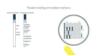 MBA Liver Profile Kit: New Era in Autoimmune Liver Diagnostics | IVDR-Certified