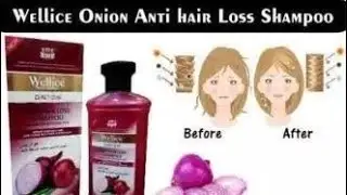 wellice onion shampoo | Hair loss l Hair loss shampoo l Ashi k channel