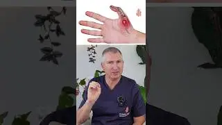 Maladia De Quervain sau tendinita care face imposibilă folosirea degetului mare