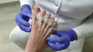 Pedisil Gel Mini Corrector (RPSIL0-0077) - by Rodiq Footcare