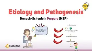 Henoch-Schonlein Purpura (HSP) Case Study | Etiology and Pathogenesis