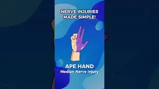 🧠 Mastering Nerve Injuries Simplified!