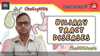 Biliary Tract Diseases | Clinical Medicine I Gallbladder stone I CBD stone.