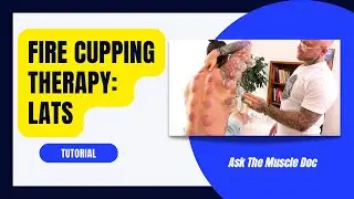 Dynamic Sports Cupping Therapy Tutorial: Latissimus Dorsi- Ask The Muscle Doc