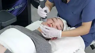 NASX Ultra-White Treatment Procedure