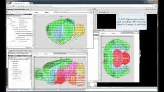 Pubanatomy 3D Section view -- 1 add/remove, 3 view modes