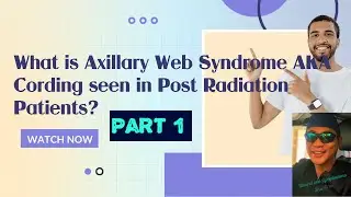 Axillary Web Syndrome AKA Cording  part 1  lymphedema wound care
