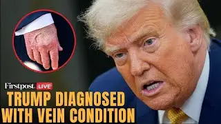 LIVE: Trump Diagnosed With Vein Disorder Amid Bruising Speculation | Trump Vein&nbsp; Condition | N18G