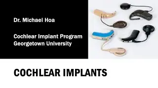 Presentation on cochlear implants