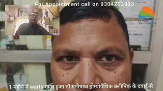 Warts Gone &bull; Piles Relief &bull; Balanitis Cure &bull;Hair Fall Control |Real Patient Review |Homeopathy Works