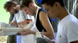 3D Printing and Deployment of Upper-Limb Prosthesis in Developing Countries
