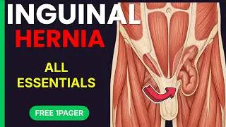 Inguinal Hernias Made Simple 🔥 | High-Yield Surgery Notes, Anatomy, Types & Repair Techniques