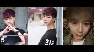 Male Plastic Surgery Before and After (Rhinoplasty, Two jaw surgery)