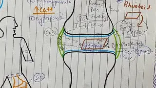 Pseudogout 2, pathophysiology, clinical features, diagnosis and treatment 