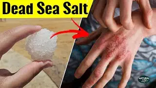Dead Sea Salt Benefits | Where to Buy Dead Sea Salt