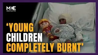 Lebanese children suffer from burns in Beirut hospital after Israeli air strike 20