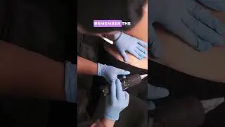 Camouflage Tattooing: Synthetic Skin VS Live Model #stretchmarkremoval #scarcamouflage