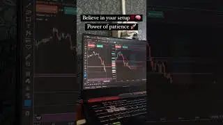 Believe in your setup | Stock Market | option strategies #trading #trending