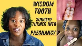 Pregnant After Wisdom Tooth Removal? The Wildest Story!
