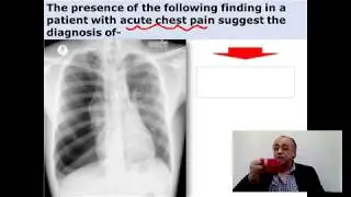Acute Chest Pain  (Note)  #cme #internal_medicine #medical #pharmaceutical #doctor #محاضرات_باطنة