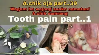 No.28)) A.chik oja part..39 # Wagam ba wajong saako namatani A.chik samrang # Tooth pain part..1