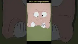 Circumcision procedure