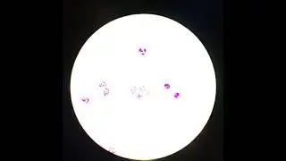 Zeiss Primo star 3147015059 test vật k&iacute;nh 100x sau sửa chữa