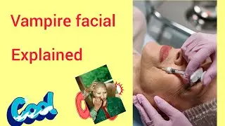 Vampire facial explained