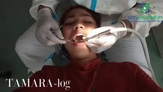 TAMARA-log 