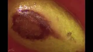 #shorts food in macro