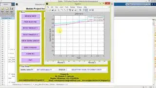 Cardiac Disease Detection from ECG Signal Matlab Project Source Code