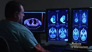 Sclerosi Multipla: Farmaci Immunosoppressori e presunto rischio infettivo, come comportarsi?