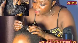 (ASMR)✨ZOOMED, SCALP NITPICKING WHITE HEADS, SUPER INTENSE, BEST HEAD SCRATCHING,