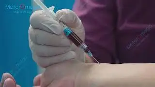 SyringeABG Arterial Blood Gas Sampler with Dry Heparin